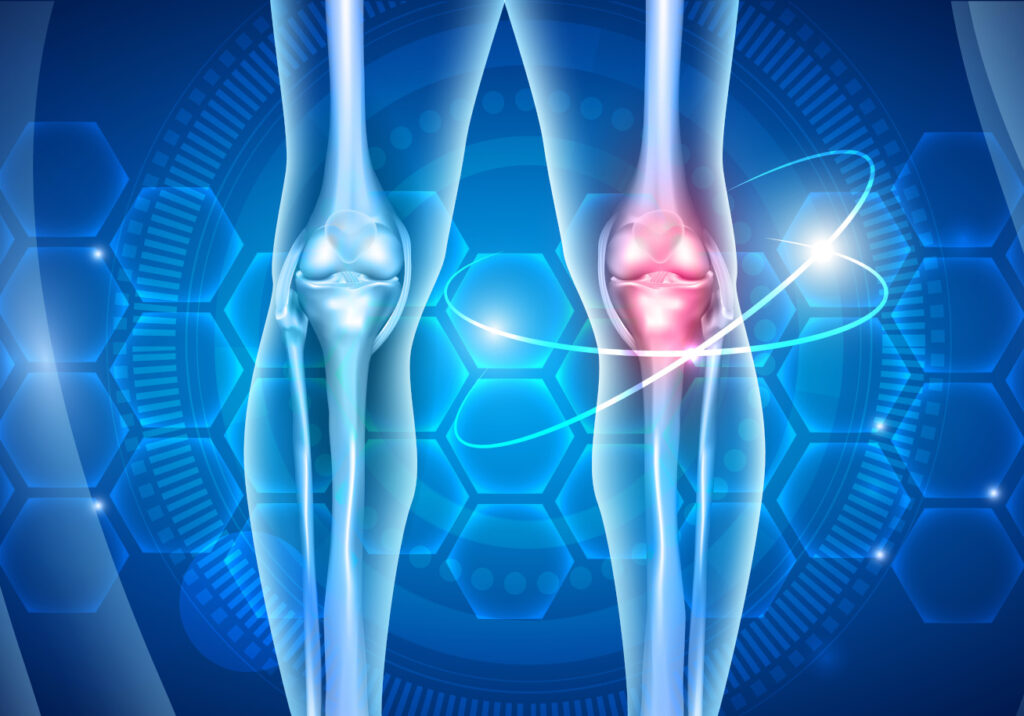 Calcitonin Peptides for Bone Health